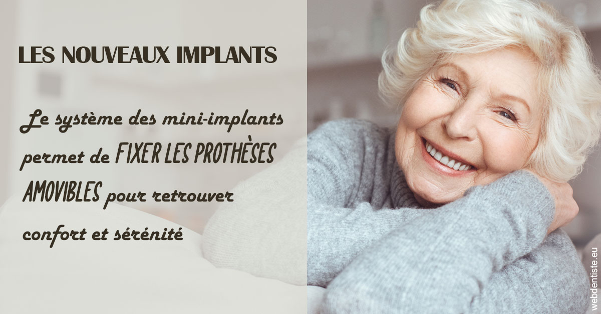 https://dr-attias-jacques.chirurgiens-dentistes.fr/Les nouveaux implants 1