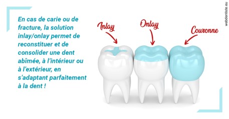 https://dr-attias-jacques.chirurgiens-dentistes.fr/L'INLAY ou l'ONLAY