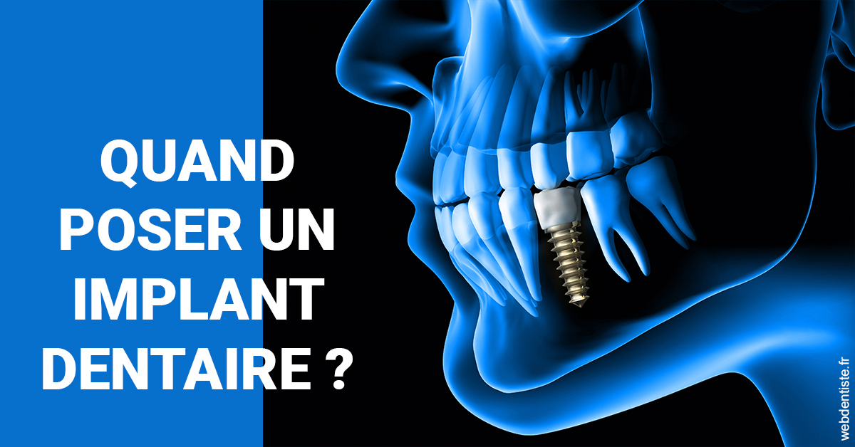 https://dr-attias-jacques.chirurgiens-dentistes.fr/Les implants 1