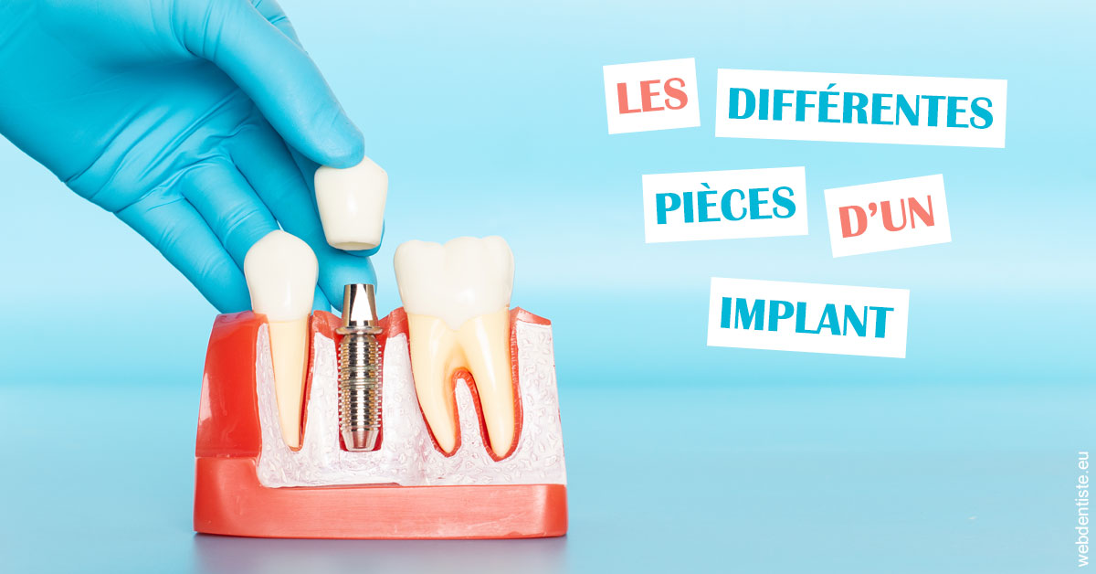 https://dr-attias-jacques.chirurgiens-dentistes.fr/Les différentes pièces d’un implant 2