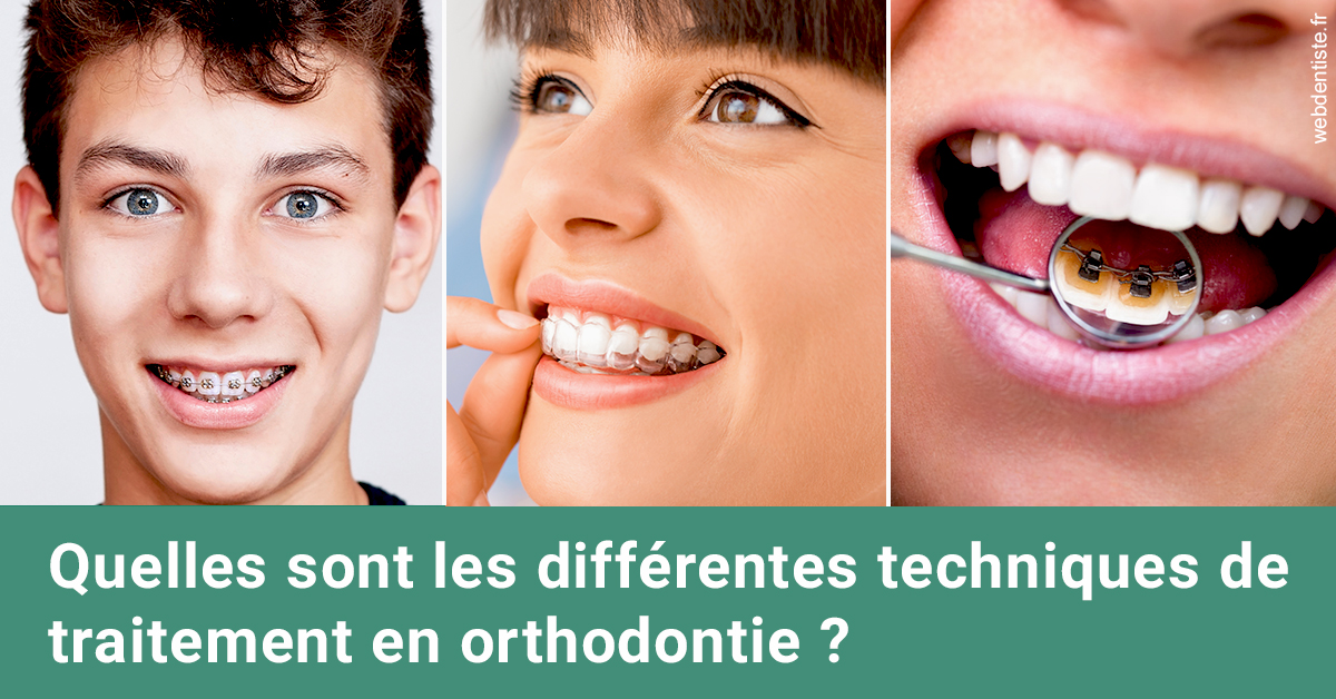 https://dr-attias-jacques.chirurgiens-dentistes.fr/Les différentes techniques de traitement 2