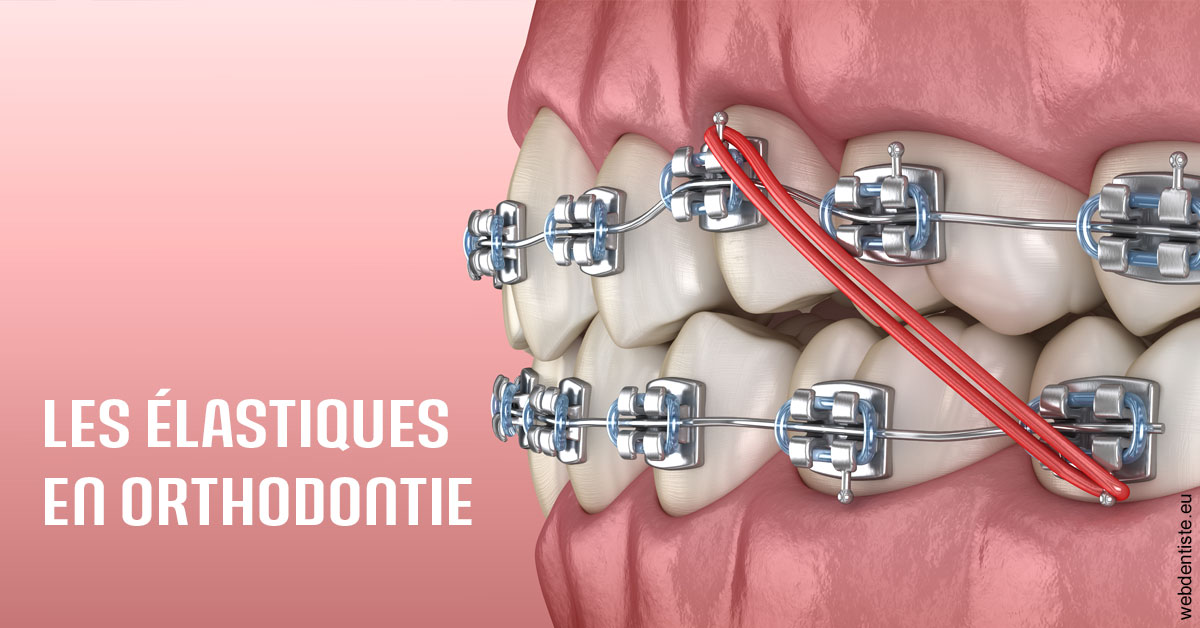 https://dr-attias-jacques.chirurgiens-dentistes.fr/Elastiques orthodontie 2