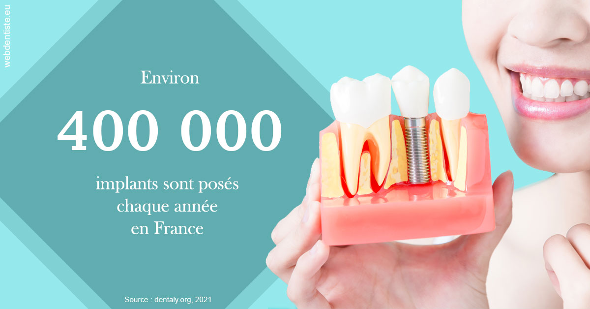 https://dr-attias-jacques.chirurgiens-dentistes.fr/Pose d'implants en France 2